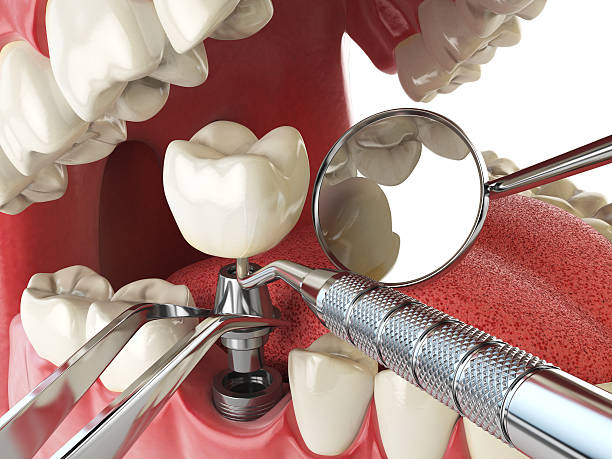 Best Emergency Cosmetic Dentistry (e.g., broken veneers) in Gallup, NM